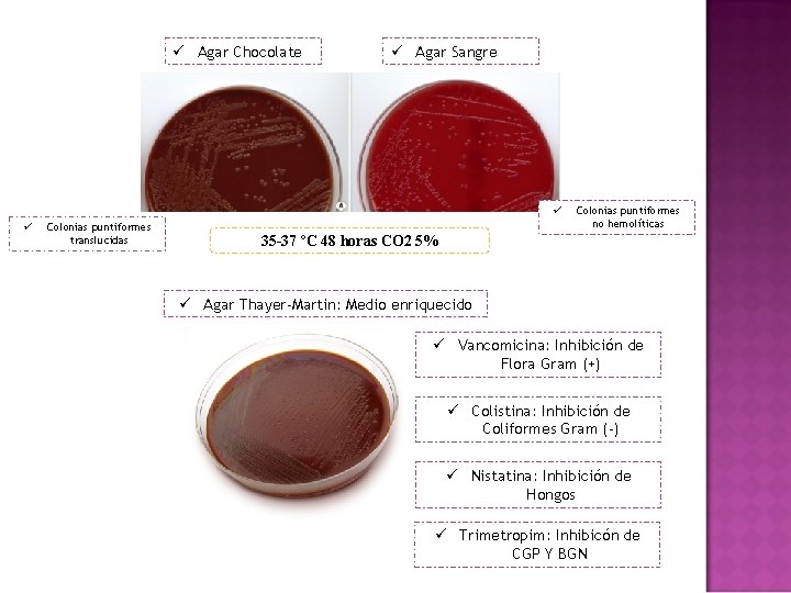 ü Agar Chocolate ü Agar Sangre ü ü Colonias puntiformes translucidas Colonias puntiformes no