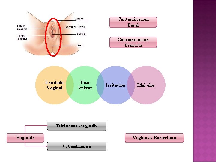 Contaminación Fecal Contaminación Urinaria Exudado Vaginal Pico Vulvar Irritación Mal olor Trichomonas vaginalis Vaginitis