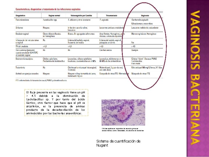 El flujo presente en las vaginosis tiene un p. H > 4. 5 debido