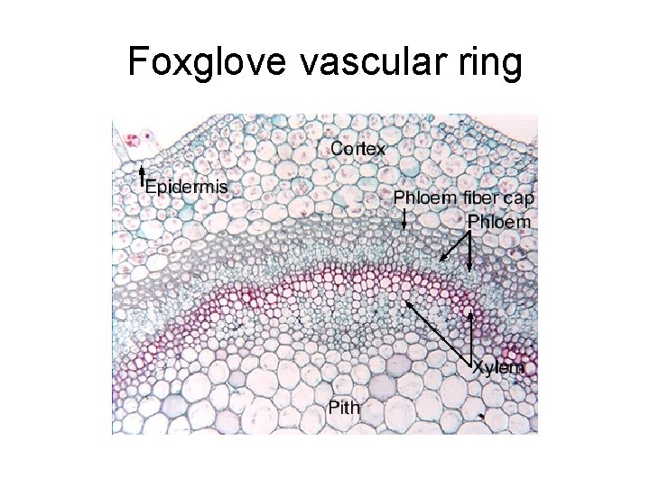 Foxglove vascular ring 