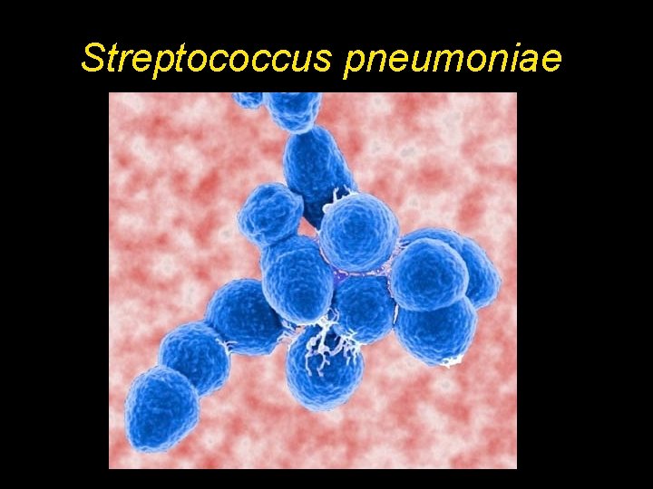 Streptococcus pneumoniae Streptococcus pneumoniae