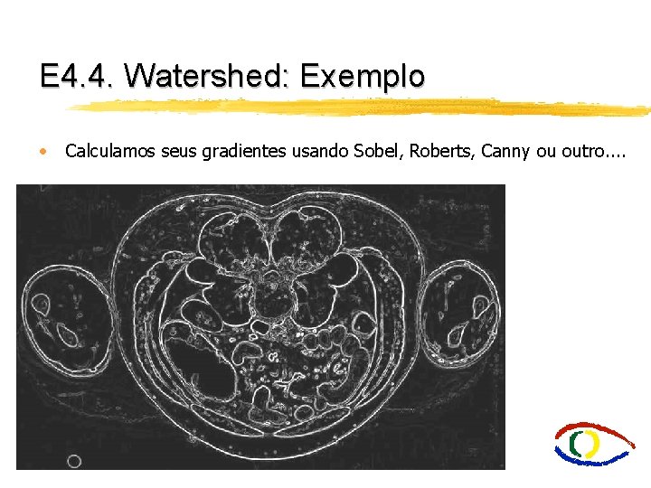 E 4. 4. Watershed: Exemplo • Calculamos seus gradientes usando Sobel, Roberts, Canny ou