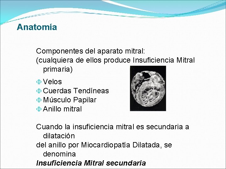 Anatomía Componentes del aparato mitral: (cualquiera de ellos produce Insuficiencia Mitral primaria) Փ Velos