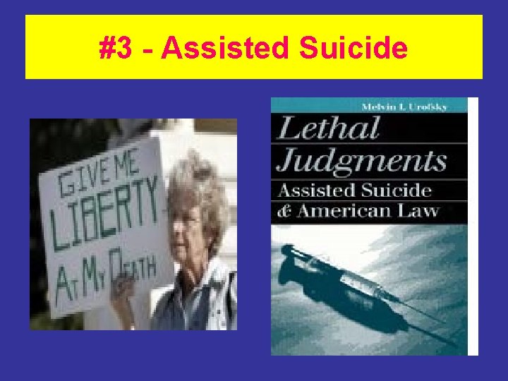 #3 - Assisted Suicide 