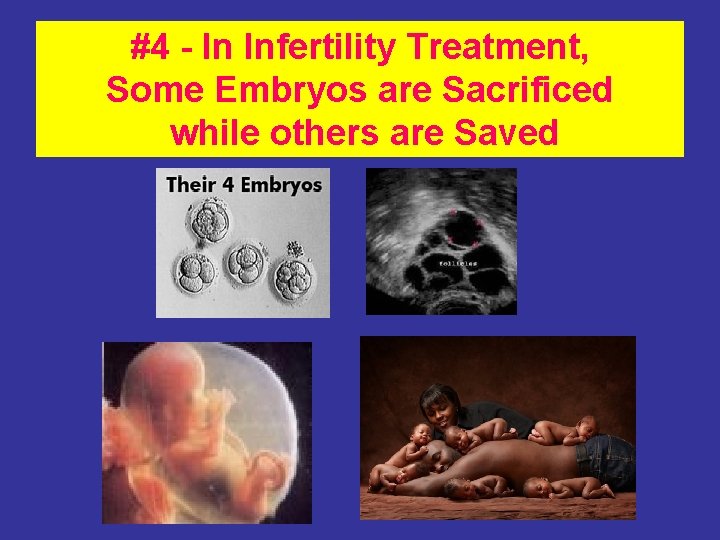 #4 - In Infertility Treatment, Some Embryos are Sacrificed while others are Saved 