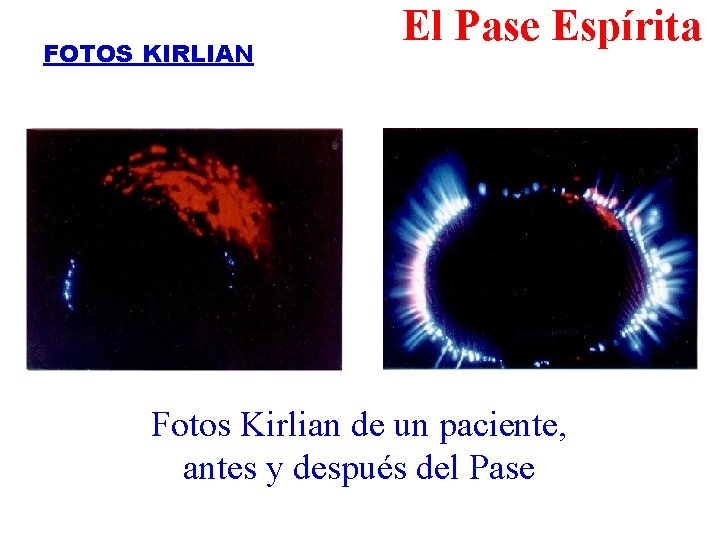 FOTOS KIRLIAN El Pase Espírita Fotos Kirlian de un paciente, antes y después del