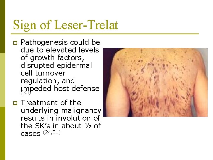 Sign of Leser-Trelat p Pathogenesis could be due to elevated levels of growth factors,