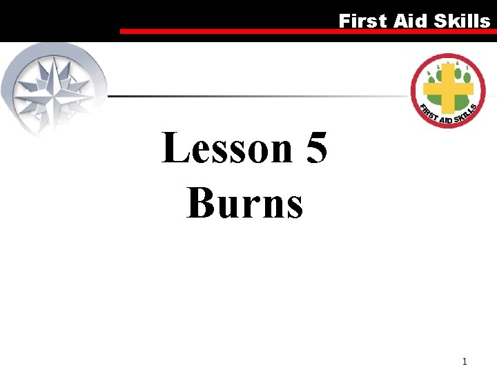 First Aid Skills Lesson 5 Burns 1 