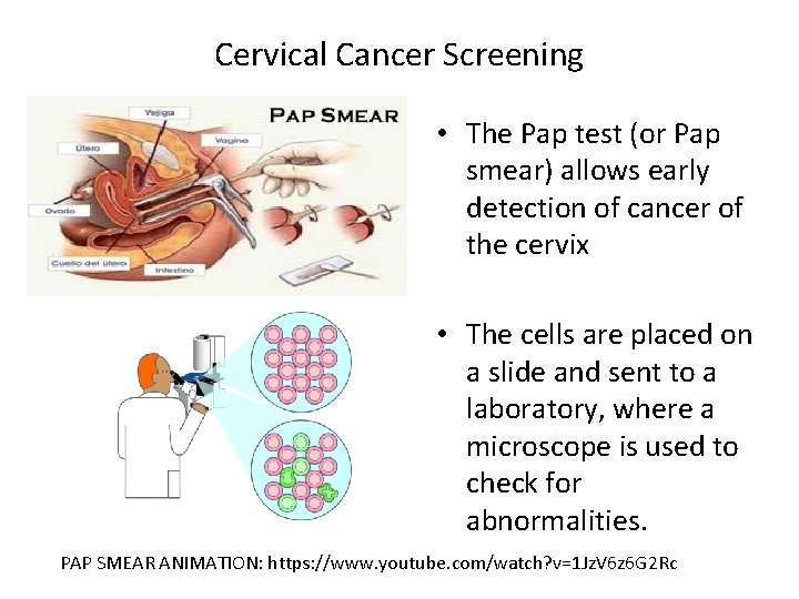 Cervical Cancer Screening • The Pap test (or Pap smear) allows early Normal smear