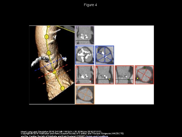 Figure 4 Heart, Lung and Circulation 2015 241149 -1161 DOI: (10. 1016/j. hlc. 2015.