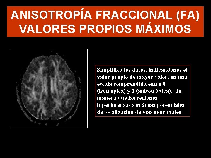 ANISOTROPÍA FRACCIONAL (FA) VALORES PROPIOS MÁXIMOS Simplifica los datos, indicándonos el valor propio de