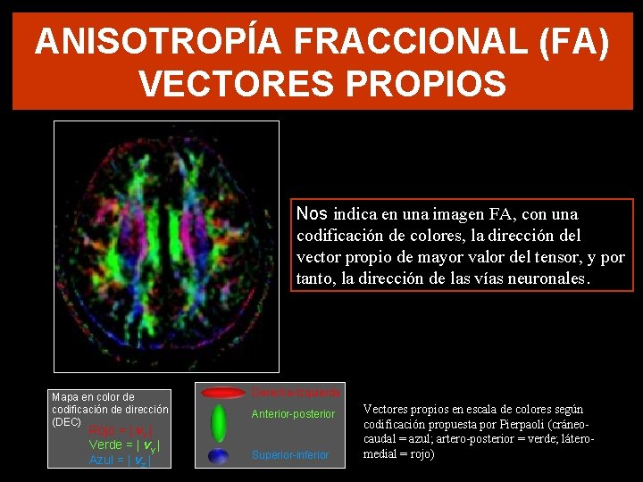 ANISOTROPÍA FRACCIONAL (FA) VECTORES PROPIOS Nos indica en una imagen FA, con una codificación