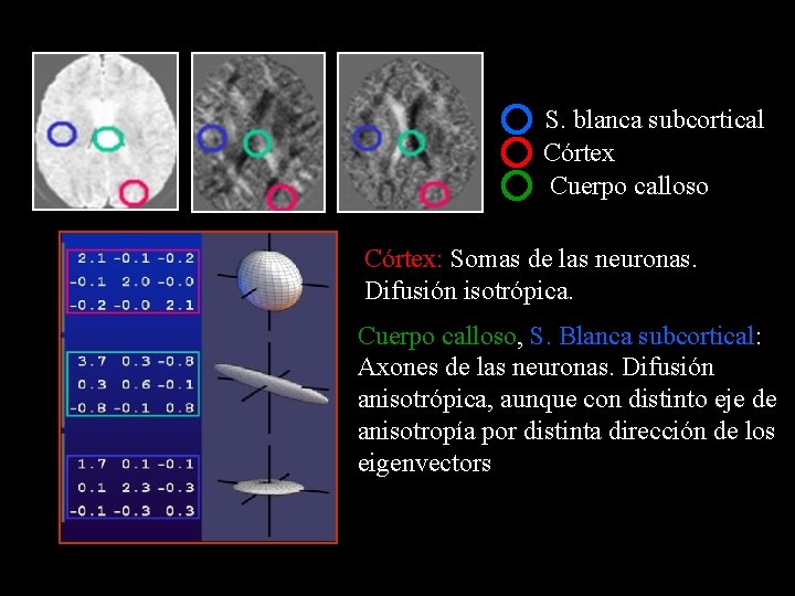 S. blanca subcortical Córtex Cuerpo calloso Córtex: Somas de las neuronas. Difusión isotrópica. Cuerpo