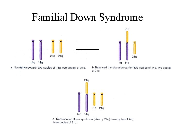 Familial Down Syndrome 