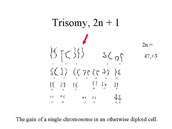 Trisomy, 2 n + 1 2 n = 46 47, +3 The gain of