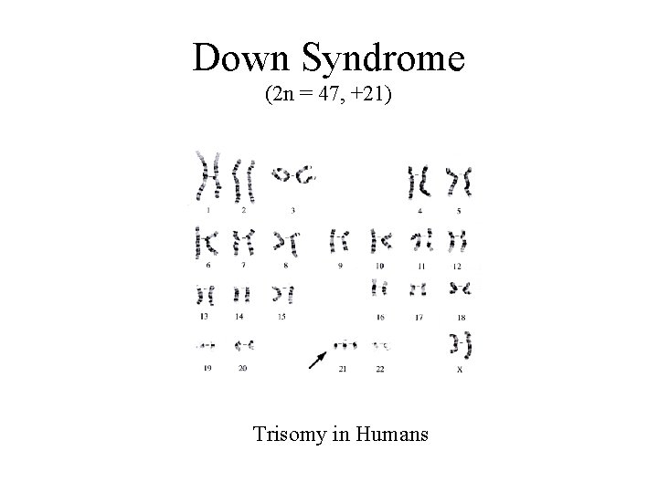 Down Syndrome (2 n = 47, +21) Trisomy in Humans 