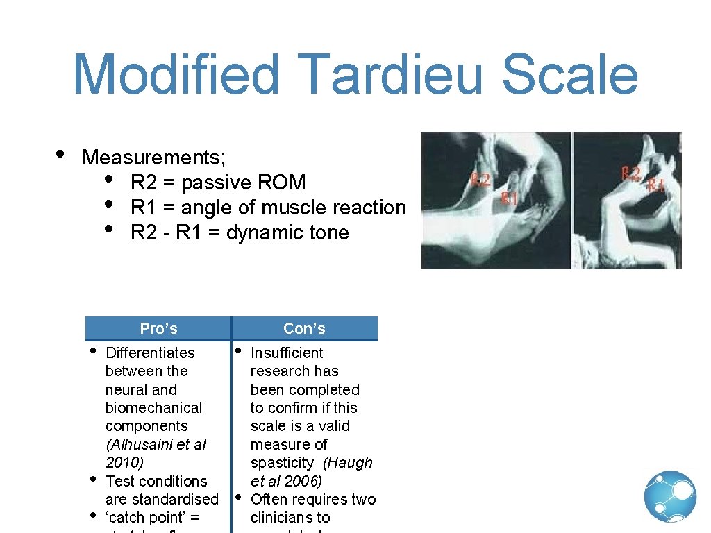 Modified Tardieu Scale • Measurements; • R 2 = passive ROM • R 1