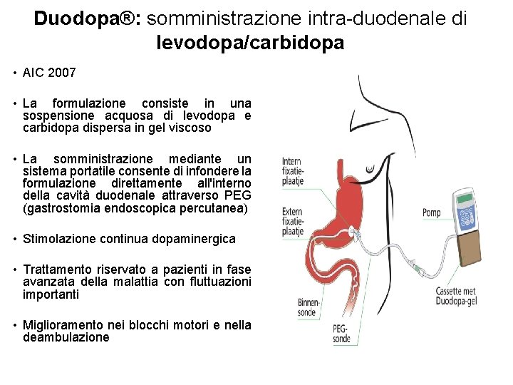Duodopa®: somministrazione intra-duodenale di levodopa/carbidopa • AIC 2007 • La formulazione consiste in una
