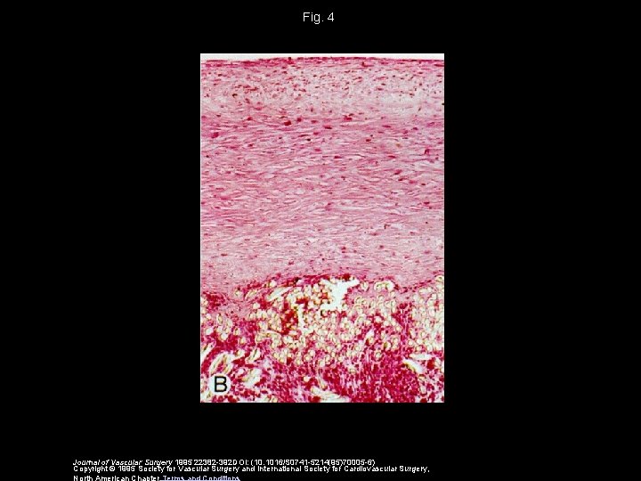 Fig. 4 Journal of Vascular Surgery 1995 22382 -392 DOI: (10. 1016/S 0741 -5214(95)70005