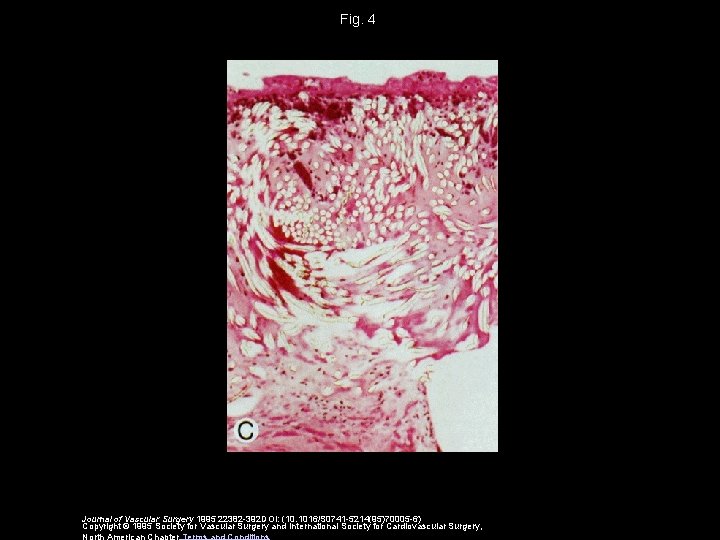 Fig. 4 Journal of Vascular Surgery 1995 22382 -392 DOI: (10. 1016/S 0741 -5214(95)70005