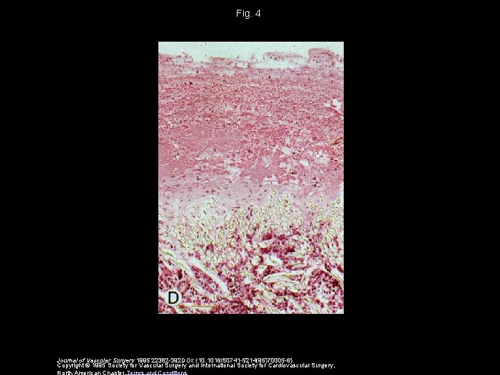 Fig. 4 Journal of Vascular Surgery 1995 22382 -392 DOI: (10. 1016/S 0741 -5214(95)70005