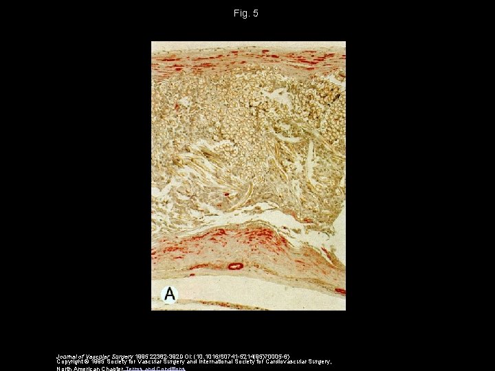 Fig. 5 Journal of Vascular Surgery 1995 22382 -392 DOI: (10. 1016/S 0741 -5214(95)70005