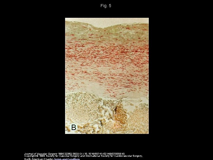 Fig. 5 Journal of Vascular Surgery 1995 22382 -392 DOI: (10. 1016/S 0741 -5214(95)70005