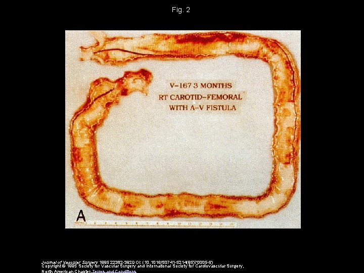 Fig. 2 Journal of Vascular Surgery 1995 22382 -392 DOI: (10. 1016/S 0741 -5214(95)70005