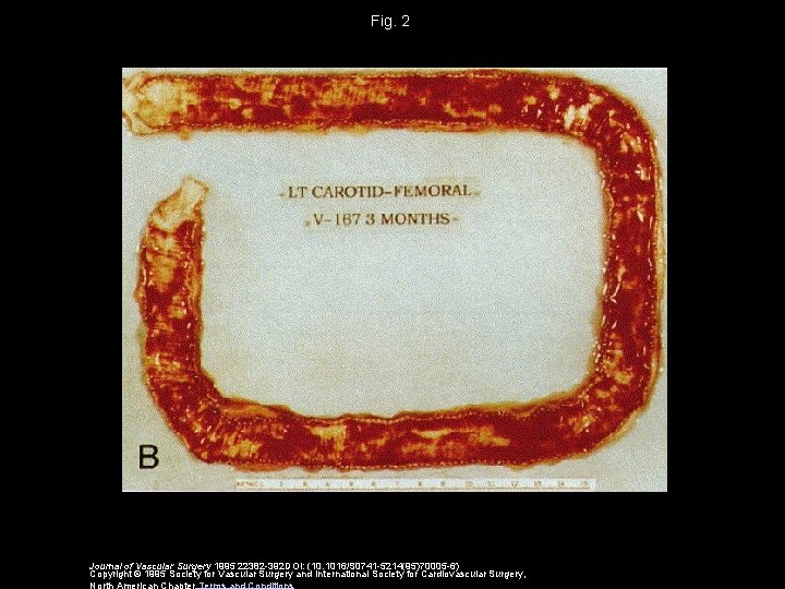 Fig. 2 Journal of Vascular Surgery 1995 22382 -392 DOI: (10. 1016/S 0741 -5214(95)70005