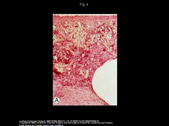 Fig. 4 Journal of Vascular Surgery 1995 22382 -392 DOI: (10. 1016/S 0741 -5214(95)70005