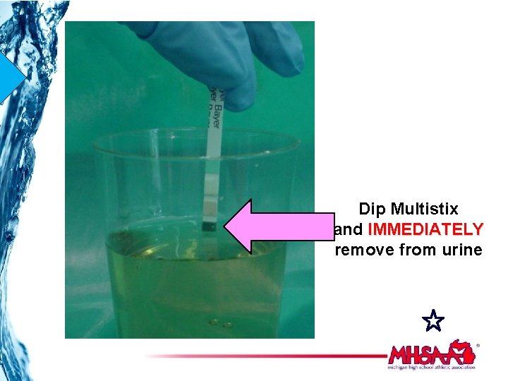 Dip Multistix and IMMEDIATELY remove from urine 