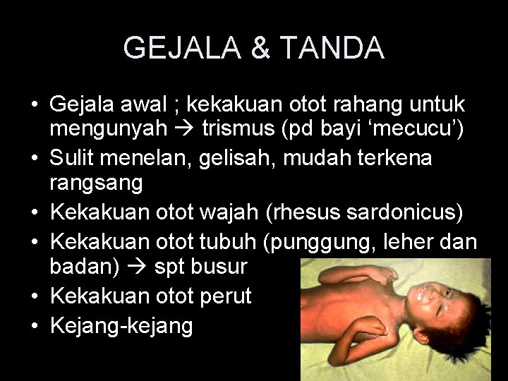 GEJALA & TANDA • Gejala awal ; kekakuan otot rahang untuk mengunyah trismus (pd