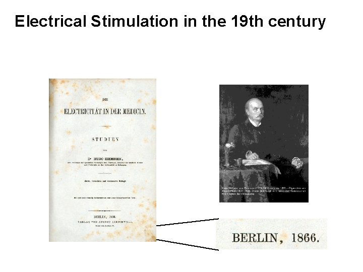 Electrical Stimulation in the 19 th century 