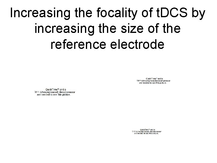 Increasing the focality of t. DCS by increasing the size of the reference electrode