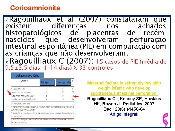 Corioamnionite üRagouilliaux et al (2007) constataram que existem diferenças nos achados histopatológicos de placentas