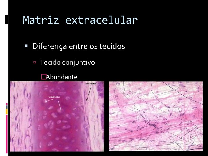 Matriz extracelular Diferença entre os tecidos Tecido conjuntivo �Abundante 