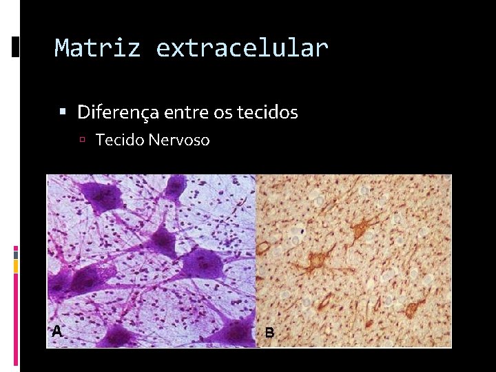 Matriz extracelular Diferença entre os tecidos Tecido Nervoso 