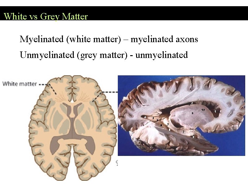 White vs Grey Matter Myelinated (white matter) – myelinated axons Unmyelinated (grey matter) - White vs Grey Matter Myelinated (white matter) – myelinated axons Unmyelinated (grey matter) -