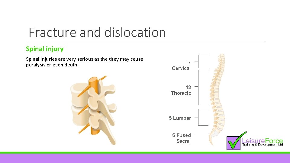 Fracture and dislocation Spinal injury Spinal injuries are very serious as they may cause