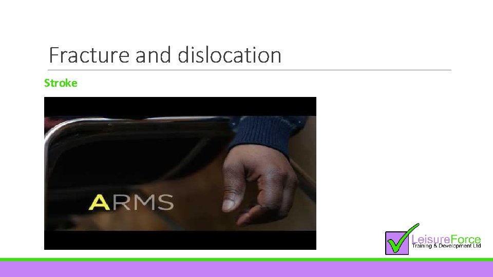 Fracture and dislocation Stroke 