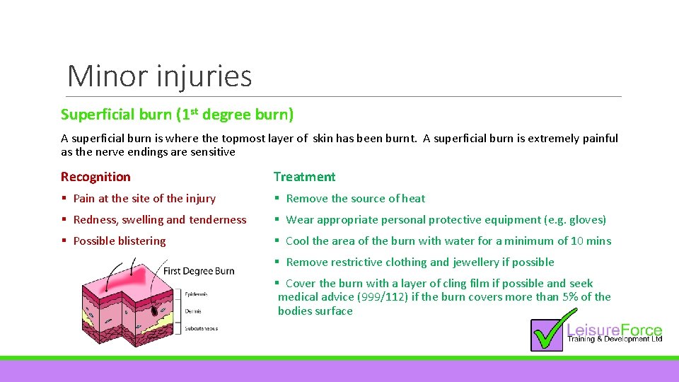 Minor injuries Superficial burn (1 st degree burn) A superficial burn is where the
