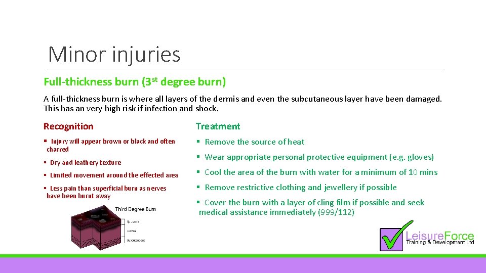 Minor injuries Full-thickness burn (3 st degree burn) A full-thickness burn is where all