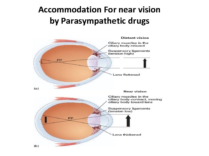 Accommodation For near vision by Parasympathetic drugs 