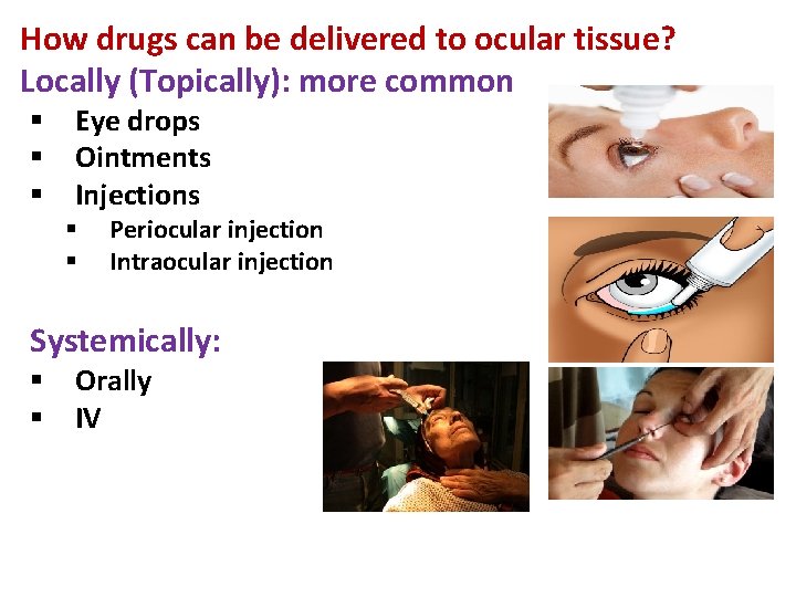 How drugs can be delivered to ocular tissue? Locally (Topically): more common § Eye How drugs can be delivered to ocular tissue? Locally (Topically): more common § Eye