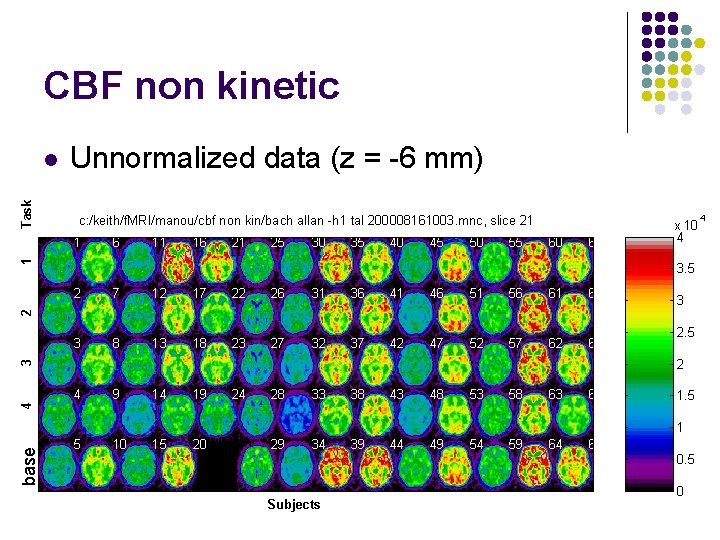 CBF non kinetic Task l Unnormalized data (z = -6 mm) c: /keith/f. MRI/manou/cbf CBF non kinetic Task l Unnormalized data (z = -6 mm) c: /keith/f. MRI/manou/cbf