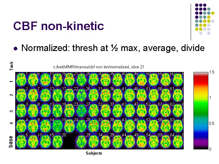 CBF non-kinetic Normalized: thresh at ½ max, average, divide Task l c: /keith/f. MRI/manou/cbf CBF non-kinetic Normalized: thresh at ½ max, average, divide Task l c: /keith/f. MRI/manou/cbf