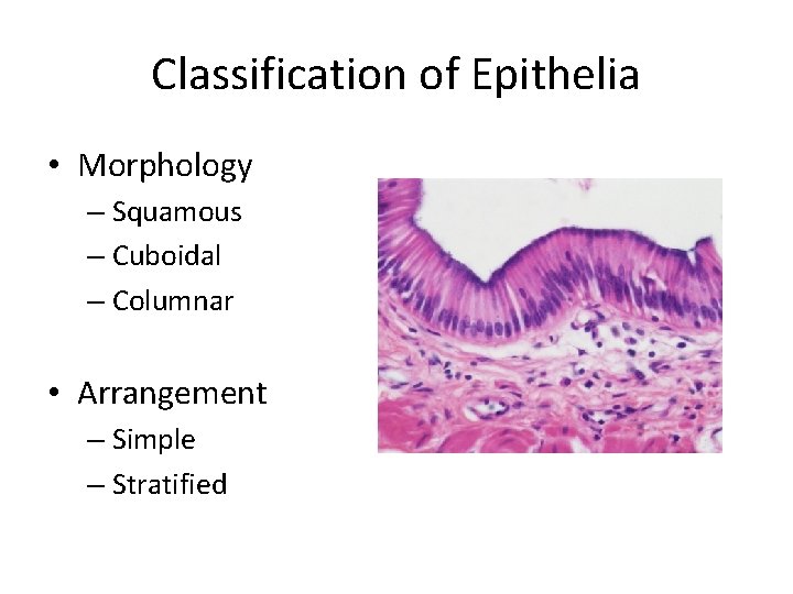 Classification of Epithelia • Morphology – Squamous – Cuboidal – Columnar • Arrangement – Classification of Epithelia • Morphology – Squamous – Cuboidal – Columnar • Arrangement –