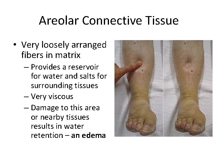 Areolar Connective Tissue • Very loosely arranged fibers in matrix – Provides a reservoir Areolar Connective Tissue • Very loosely arranged fibers in matrix – Provides a reservoir