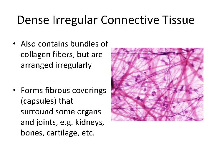 Dense Irregular Connective Tissue • Also contains bundles of collagen fibers, but are arranged Dense Irregular Connective Tissue • Also contains bundles of collagen fibers, but are arranged