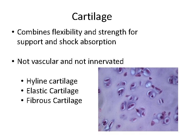 Cartilage • Combines flexibility and strength for support and shock absorption • Not vascular